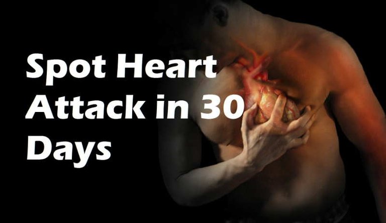 30-Days-Heart-Attack.jpg