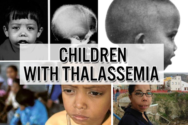 thalasemia22.jpg