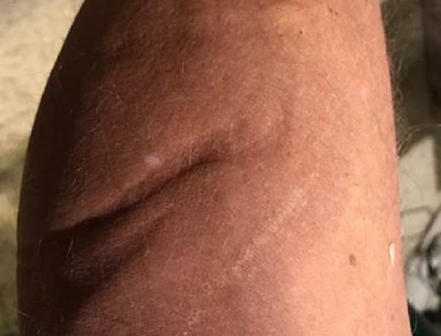 John Edmonds alien scar.jpg