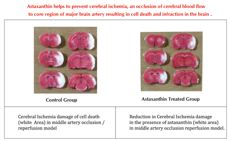 Astaxanthin3.png