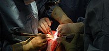 220px-Toby-meltzer-performing-surgery.jpg