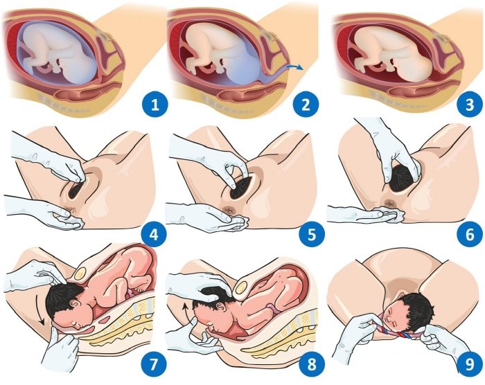 분만과정.jpg
