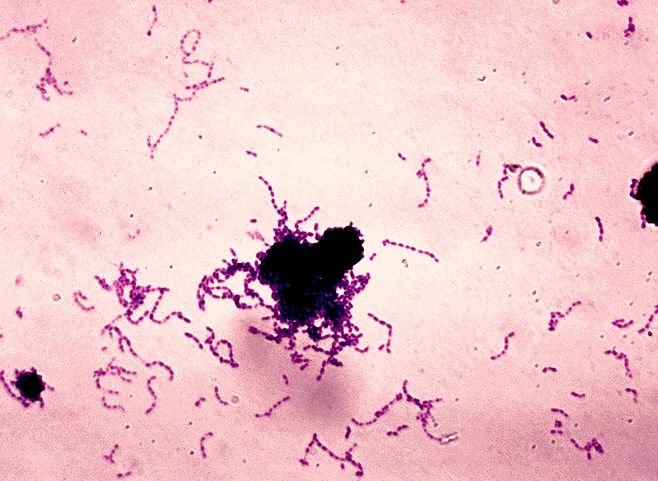 Streptococcus_mutans_01.jpg