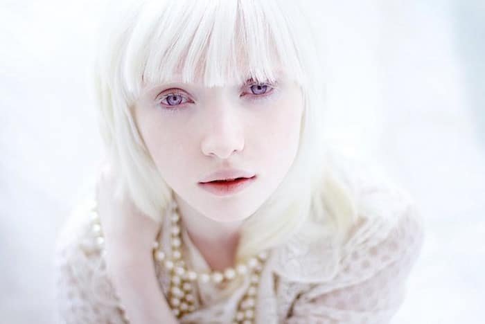 El-albinismo.jpg