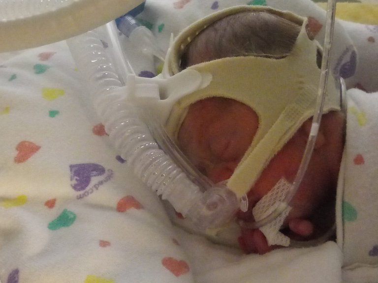 cpap victoria.jpg