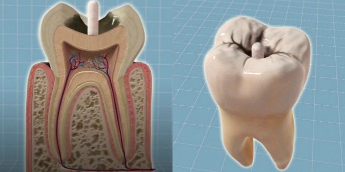 tooth-main.jpg