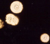 cryptococcus_directo Tinta China.jpg