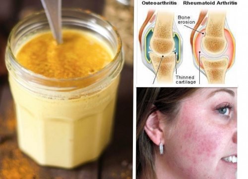 See-What-Drinking-Turmeric-Golden-Milk-Before-Bed-Will-Do-T0-Your-Body-1-1.jpg