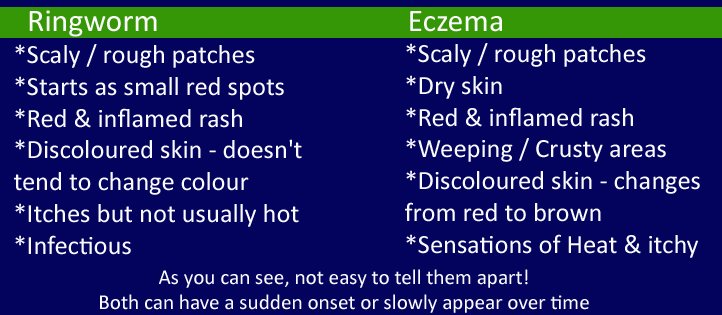 ringworm-v-eczema.jpg