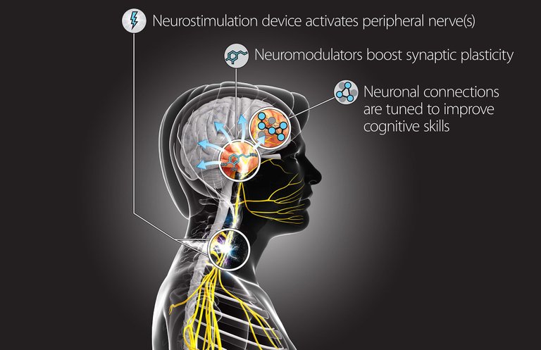 darpa-hack-brain-neurostimulation-device.jpg