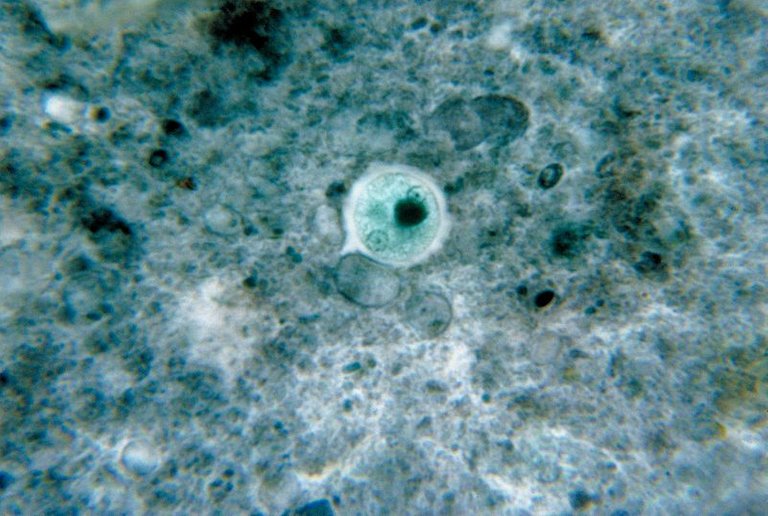 800px-Entamoeba_histolytica_01.jpg