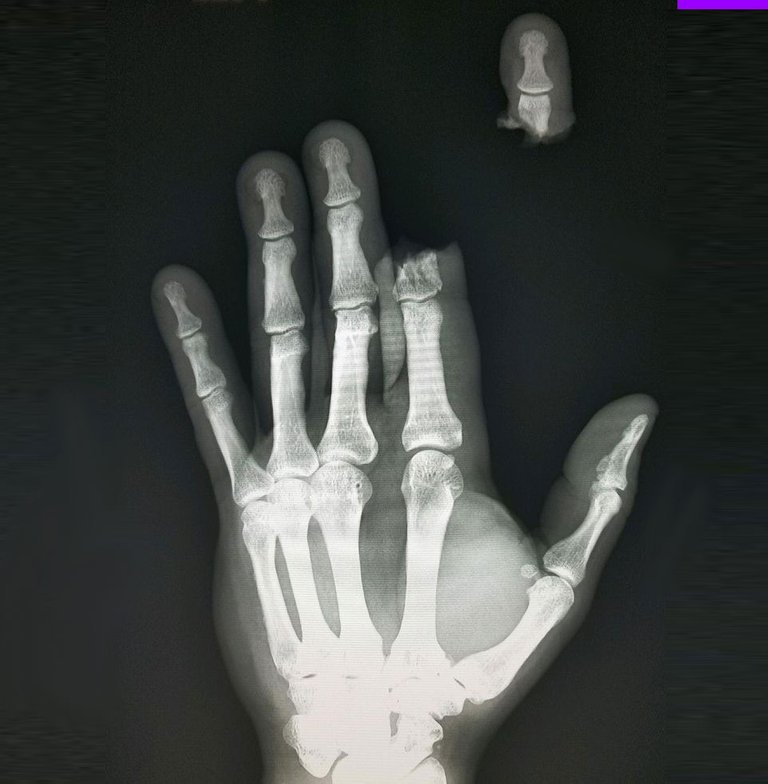 XRAYHAND.jpg