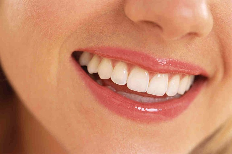 teethwhitening-faq.jpg