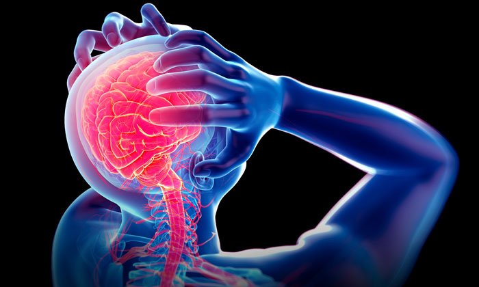 migraine-FOR-WEB.jpg