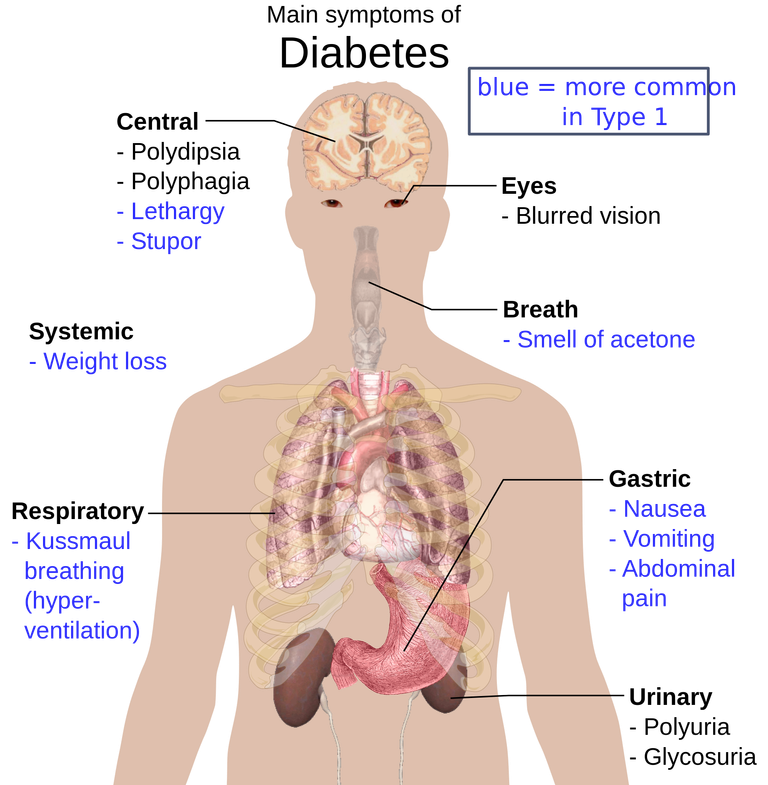 2000px-Main_symptoms_of_diabetes.svg.png