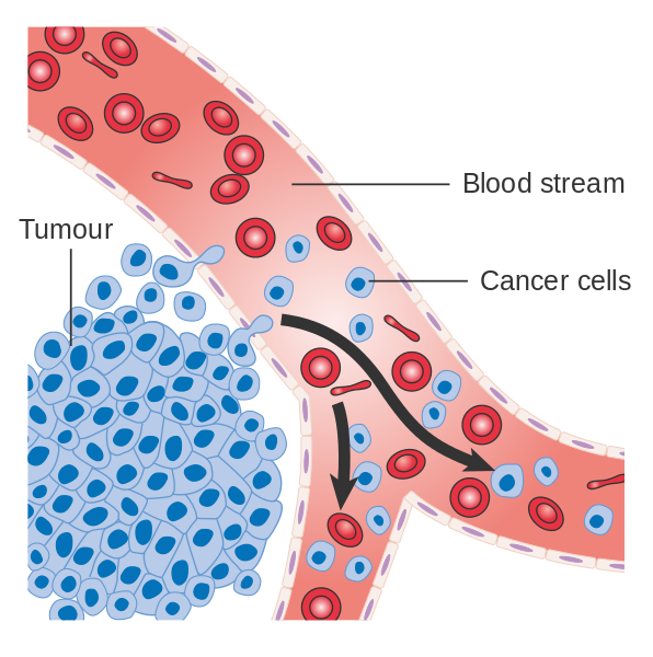 Diagram_showing_cancer_cells_spreading_into_the_blood_stream_CRUK_448.svg.png