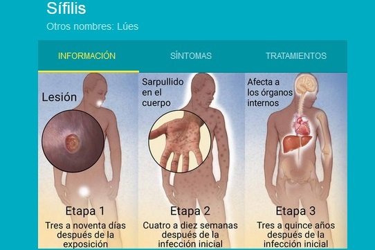 sifilis-salud-2.jpg