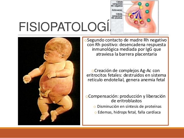 enfermedad-hemoltica-fetal-por-incompatibilidad-rh-6-638.jpg