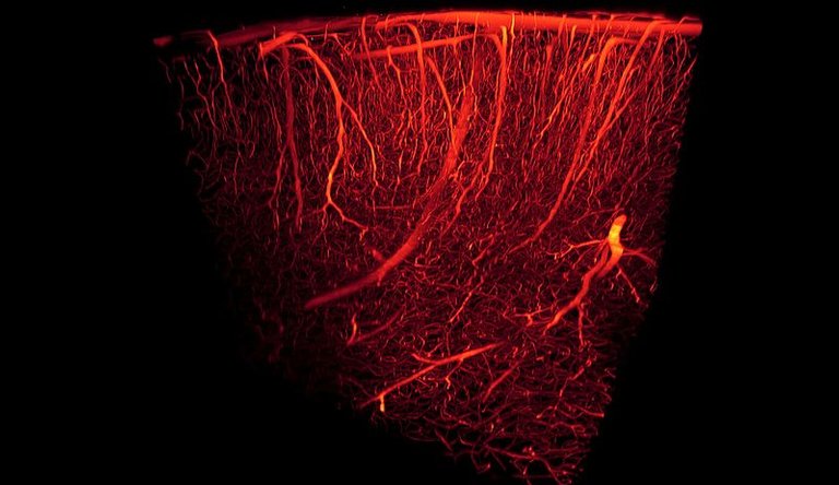 Blood_vessels-3D_rendering.jpg