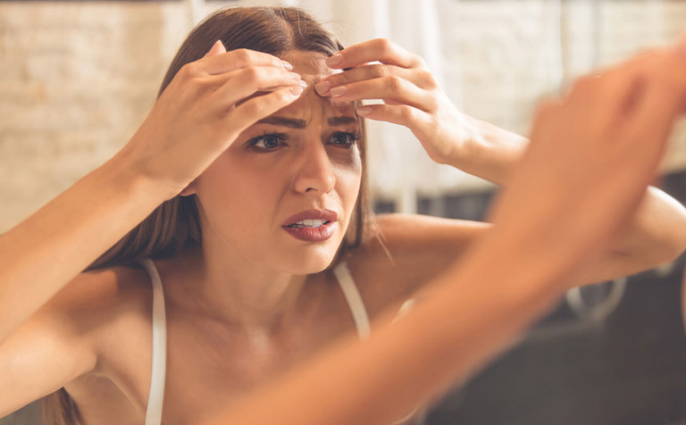 New Vaccine to Offer Treatment for Acne.png