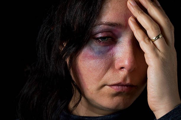 domestic-violence-victim-picture-id171101727.jpg