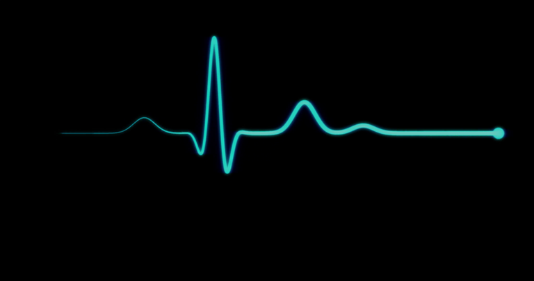 ekg-line-ekg-monitor-ekg-machine-heart-health-blue-ecg-monitor-shows-the-heart-beat-the-heart-stops-for-three-seconds-and-starts-again_nelyjny6x__F0000.png