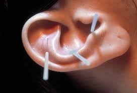 acup ear.jpg
