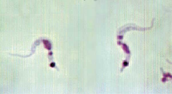 Trypanosoma_cruzi_hindgut.jpg