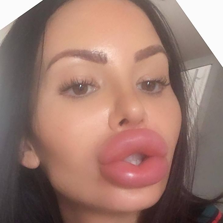 lips.jpg