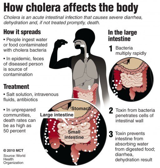 cholera1.jpg