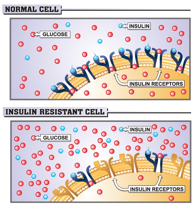 insulin-resistance1.jpg
