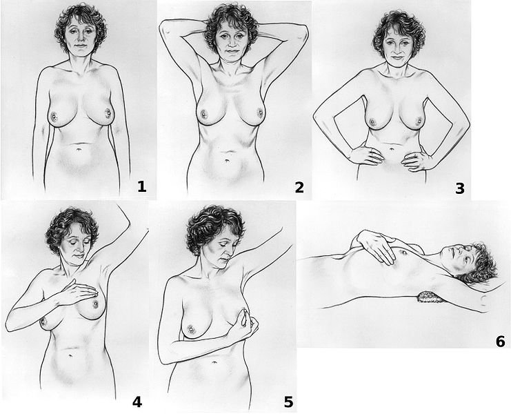 741px-Breast_self-exam_NCI_visuals_online.jpg