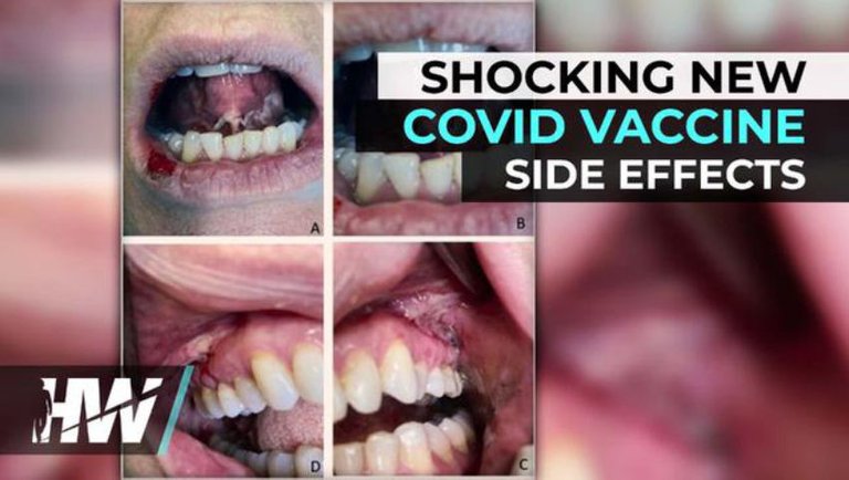 SHOCKING NEW COVID VACCINE SIDE EFFECTS