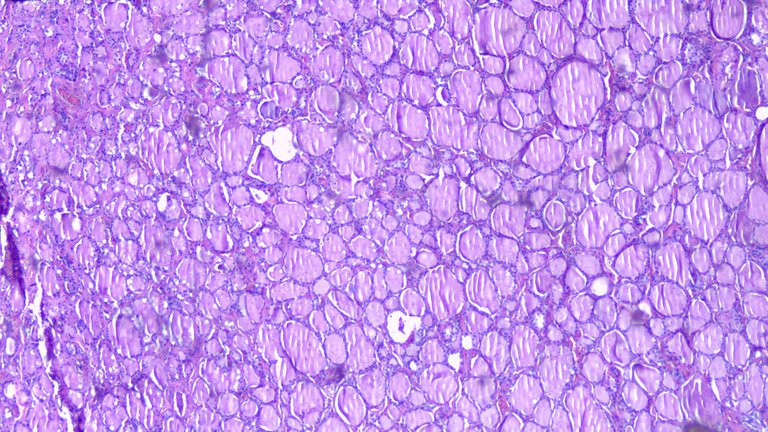 Thyroid Tissue Scan.png