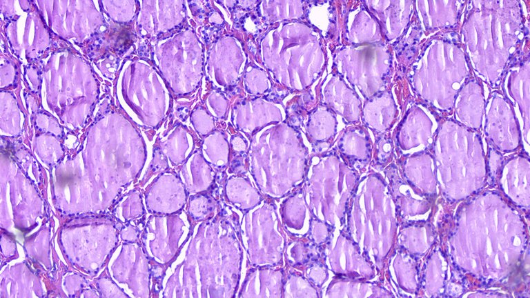 Thyroid Tissue LPF.png