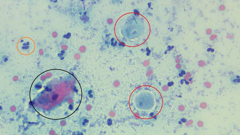 Trichomonas LPO 2 marked.jpg