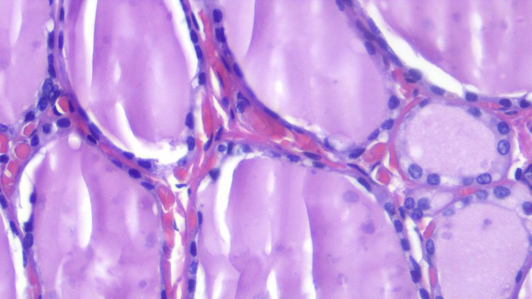 Thyroid Tissue HPF.png