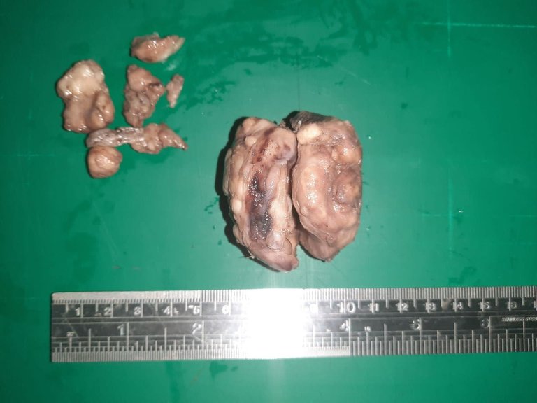 Prostate anterior.jpg