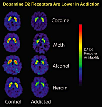 Dopamine_D2_Receptors_in_Addiction DEBRA P. DAVIS govt public.png