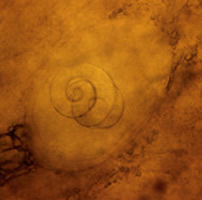 Trichinella_larvaeA cdc.png