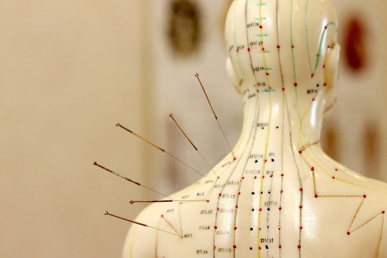 acupuntura.jpg