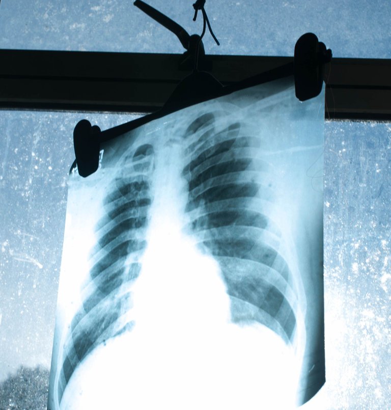 x-ray-03.jpg