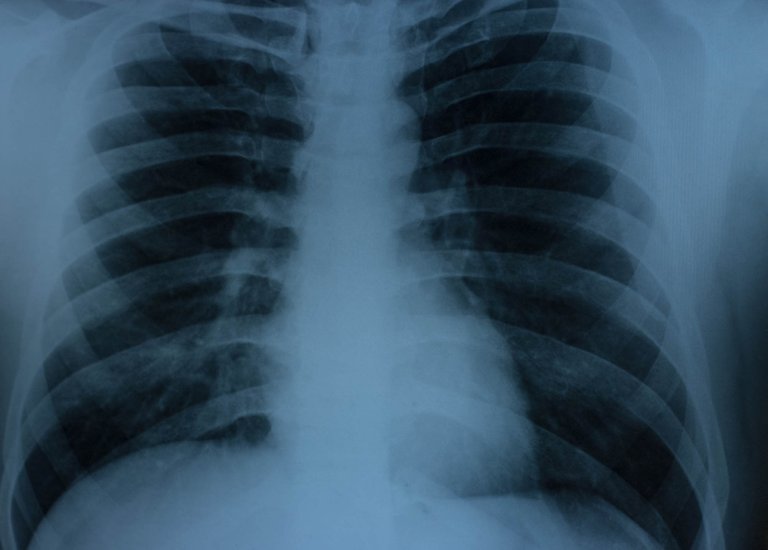 x-ray-07.jpg