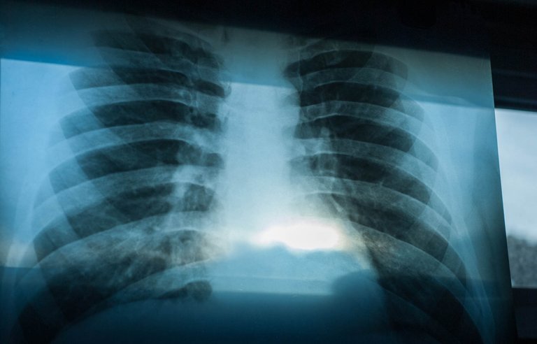 x-ray-04.jpg