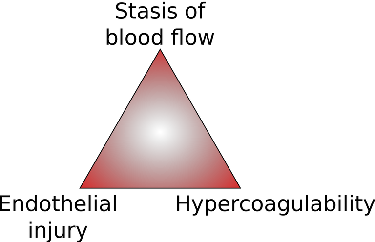 2000px-Virchow's_Triad.svg.png