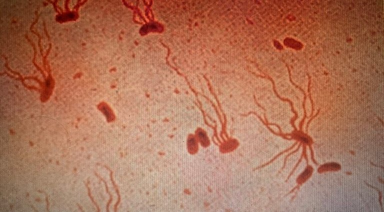 SalmonellaTyphiFlagellarStain.jpg