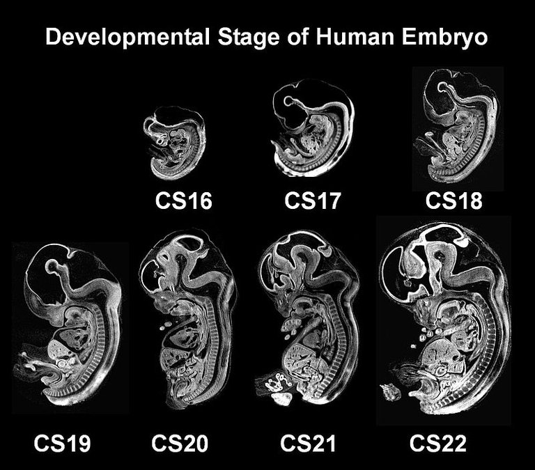 MRM_of_human_embryo_at_400MHz.jpg