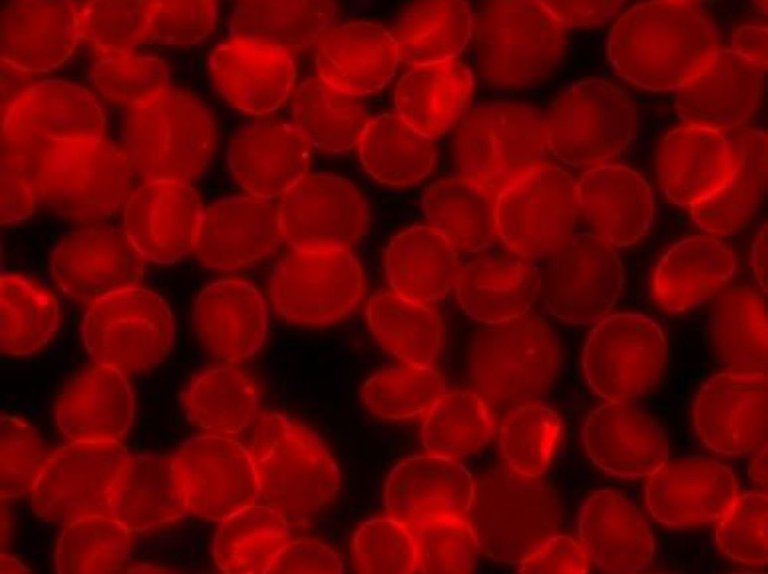 2000px-Sedimented_red_blood_cells_1.jpg