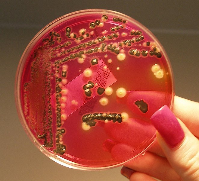 Salmonella_growing_on_XLD_agar.JPG