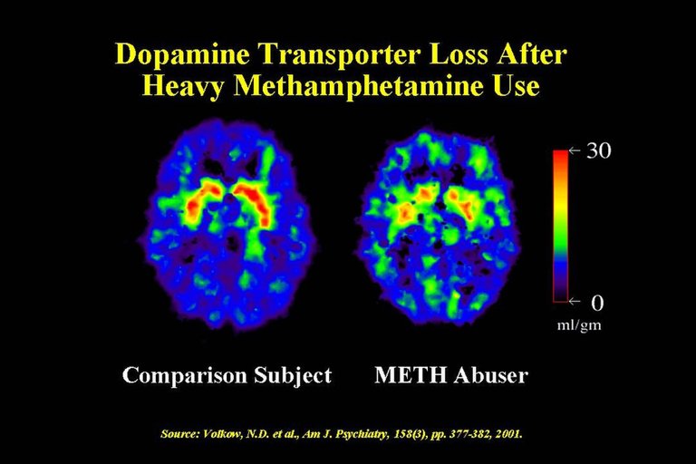 Dopamine_Transporter_Meth.jpg